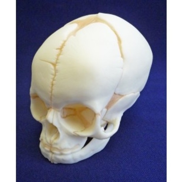 ESP Model Foetal Skull (ZJY-420-R)