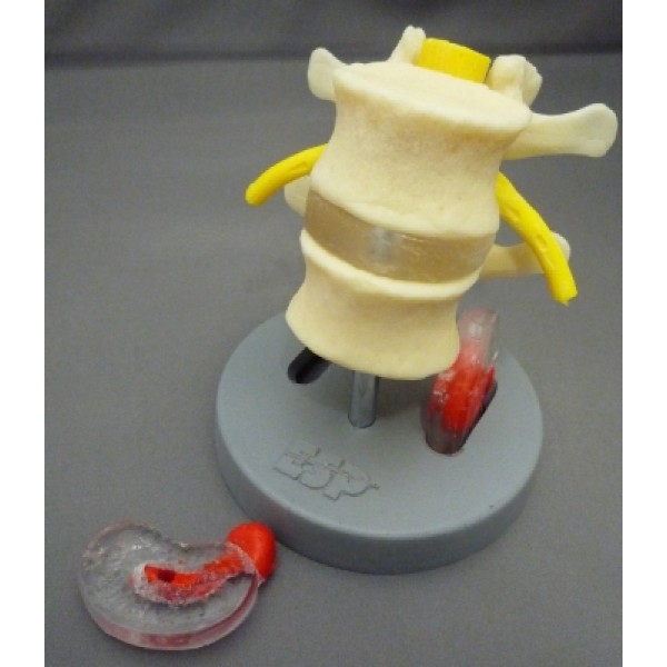 ESP Model Dissectible Lumbar Vertebrae (ZJZ-220-D)