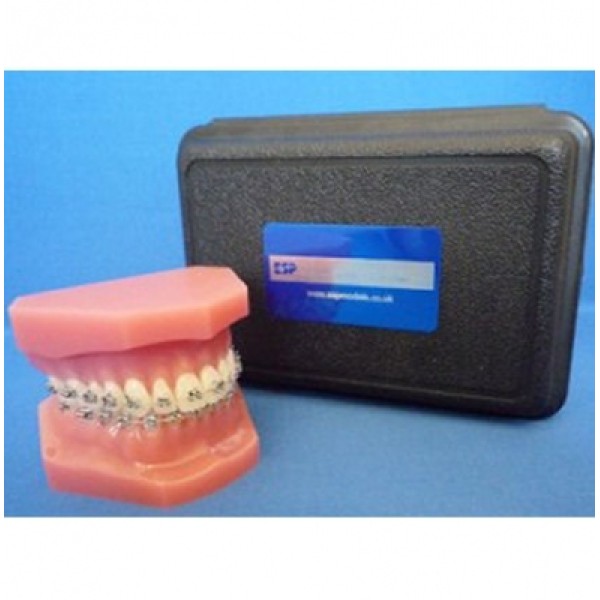 ESP Model Orthodontic Maxilla & Mandible with Fixed Braces (ZDM-005-OR)