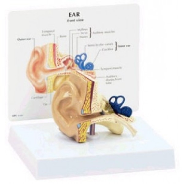 ESP Model Ear Budget Model (GBM-003)