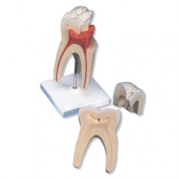 ESP Model Upper Molar Tooth 3 Part (ZKH-810-G)