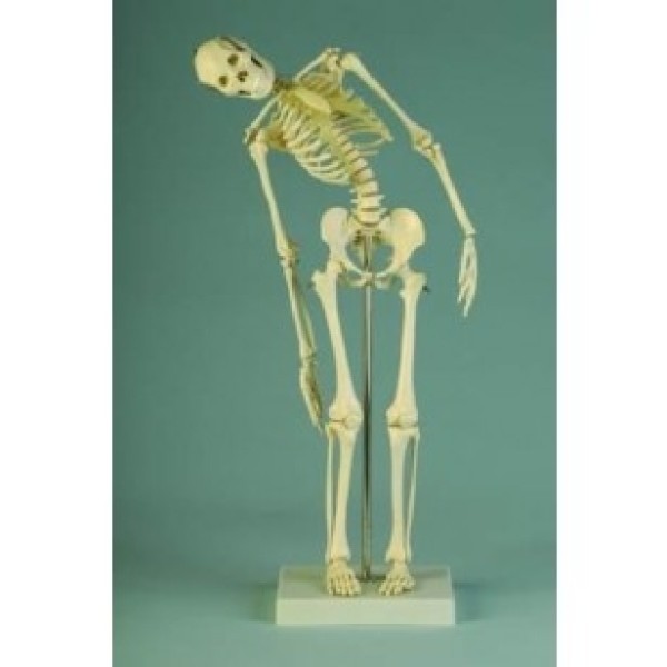 ESP Model Miniature Skeleton with Flexible Spine (ZJY-275-Q)