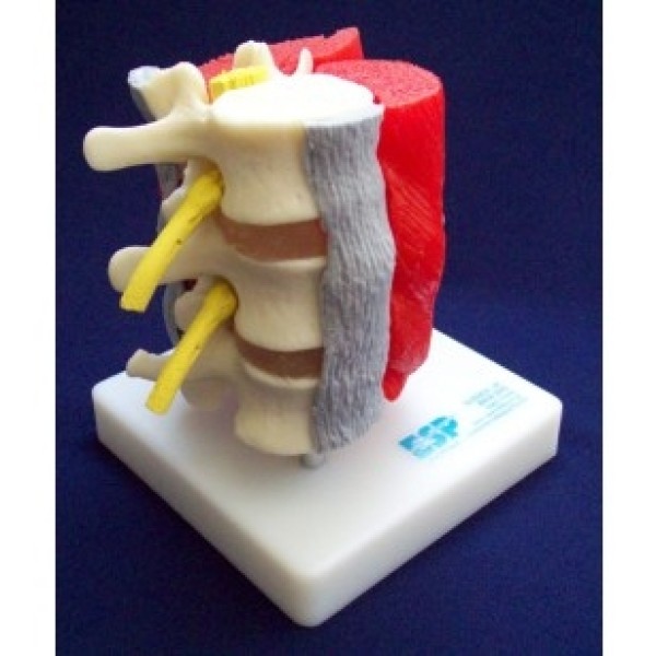 ESP Model Lumbar Vertebrae with Muscles (ZJZ-205-M)