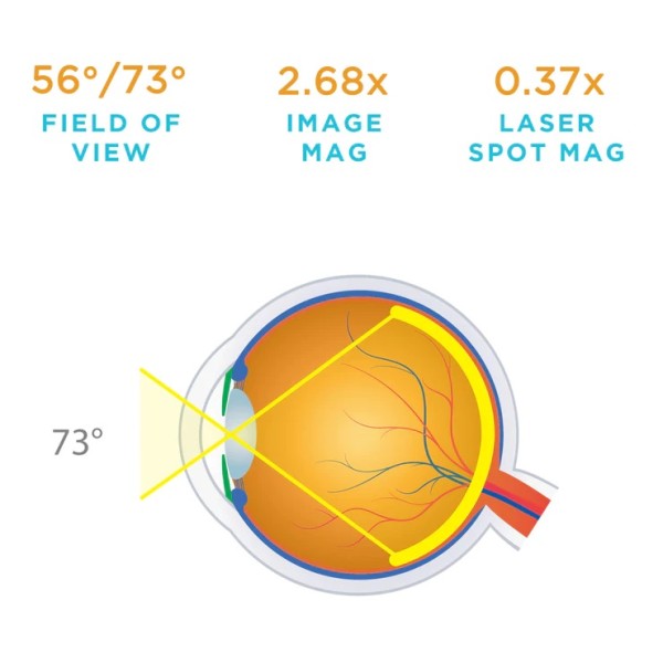 Volk 2.2x Pan Retinal Lens (2105-P-1017)