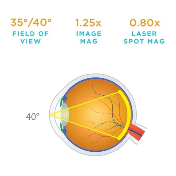 Volk Fundus Laser Lens (2105-L-1736)