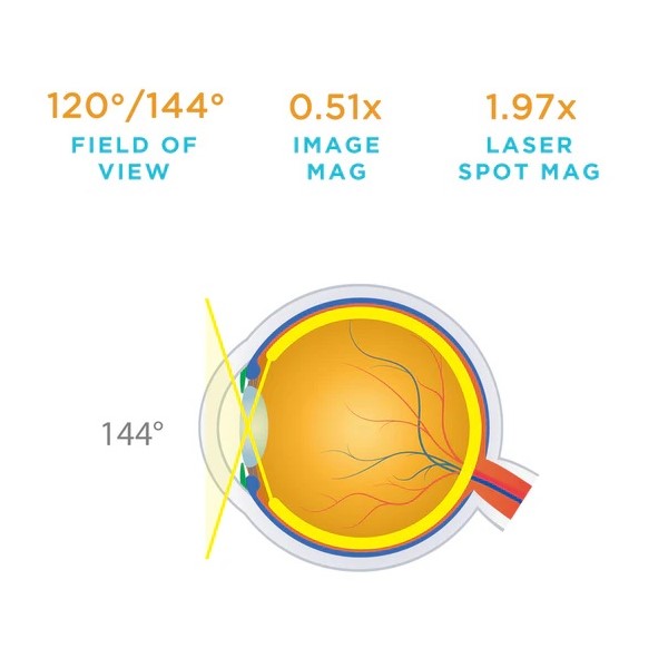 Volk QuadrAspheric Lens (2105-P-1076)